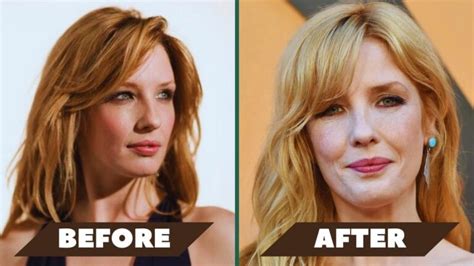 kelly reilly surgery|Exploring Kelly Reillys Upper Lip